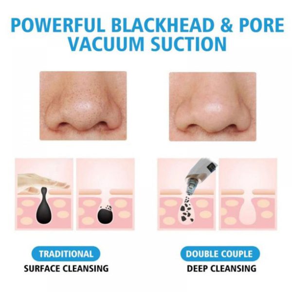 Blackhead Suction Remover